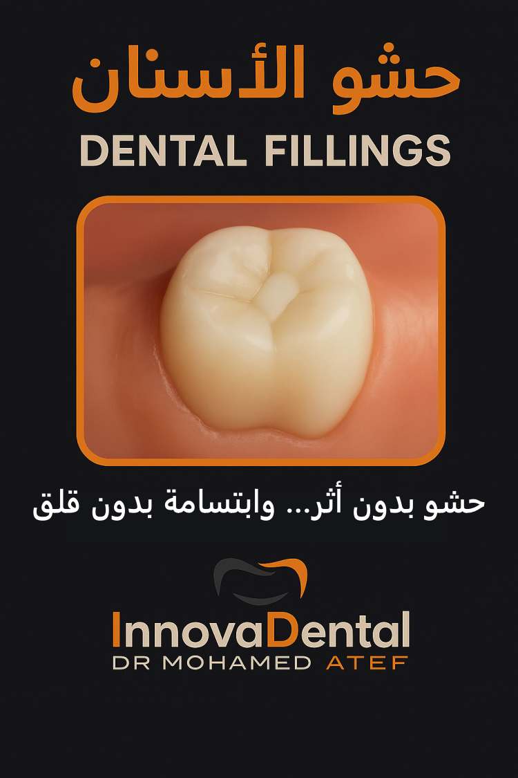 Dental filling